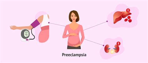 preeclampsia postparto